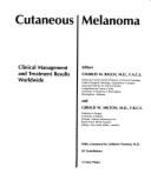 Cutaneous Melanoma: Clinical Management and Treatment Results Worldwide