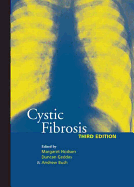 Cystic Fibrosis - Hodson, Margaret, and Geddes, Duncan, MD, Frcp, and Bush, Andrew