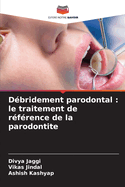 D?bridement parodontal: le traitement de r?f?rence de la parodontite