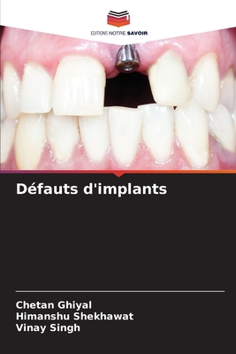 D?fauts d'implants - Ghiyal, Chetan, and Shekhawat, Himanshu, and Singh, Vinay