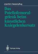 Das Patellofemoralgelenk Beim Kunstlichen Kniegelenkersatz