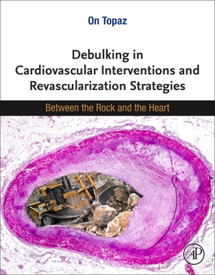 Debulking in Cardiovascular Interventions and Revascularization Strategies: Between a Rock and the Heart - Topaz, On (Editor)