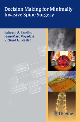 Decision Making for Minimally Invasive Spine Surgery - Sandhu, Faheem A (Editor), and Voyadzis, Jean-Marc (Editor), and Fessler, Richard Glenn (Editor)