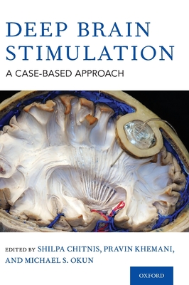 Deep Brain Stimulation: A Case-based Approach - Chitnis, Shilpa (Editor), and Khemani, Pravin, MD (Editor), and Okun, Michael S. (Editor)