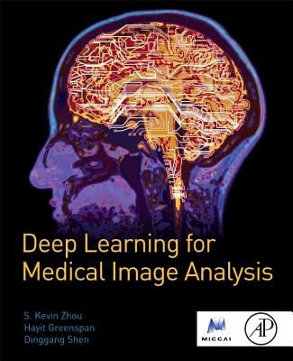 Deep Learning for Medical Image Analysis - Zhou, S. Kevin (Editor), and Greenspan, Hayit (Editor), and Shen, Dinggang (Editor)