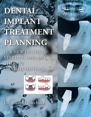 Dental Implant Treatment Planning for New Dentists Starting Implant Therapy - Obiechina, Nkem, Dr.