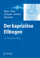 Der kaprizise Ellbogen: 51 instruktive Flle