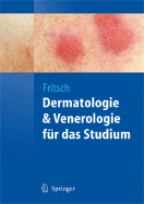 Dermatologie Und Venerologie Fur Das Studium