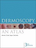 Dermoscopy: An Atlas 3e