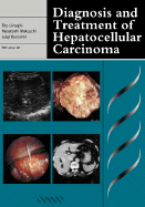Diagnosis and Treatment of Hepatocellular Carcinoma - Livraghi, Tito (Editor), and Makuuchi, Masatoshi (Editor), and Buscarini, Luigi (Editor)