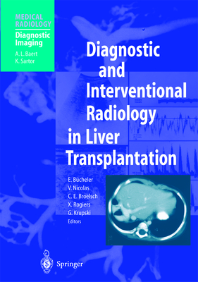 Diagnostic and Interventional Radiology in Liver Transplantation - Bcheler, E. (Editor), and Nicolas, V. (Editor), and Broelsch, C.E. (Editor)