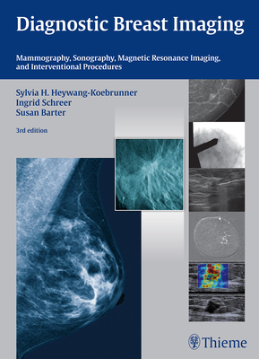 Diagnostic Breast Imaging: Mammography, Sonography, MRI and Interventional Procedures - Heywang-Kbrunner, Sylvia H, and Schreer, Ingrid, and Barter, Susan