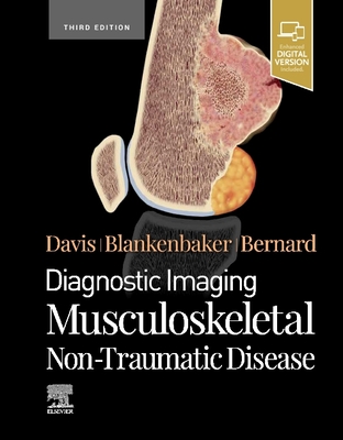 Diagnostic Imaging: Musculoskeletal Non-Traumatic Disease - Davis, Kirkland W, MD, Facr, and Blankenbaker, Donna G, MD, Facr, and Bernard, Stephanie, MD