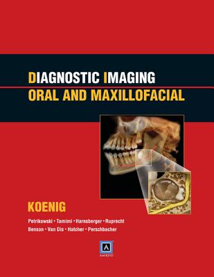 Diagnostic Imaging: Oral and Maxillofacial: Published by Amirsys - Koenig, Lisa J.