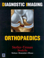 Diagnostic Imaging: Orthopaedics - Stoller, David W, MD, Facr, and Tirman, Phillip F J, MD, and Bredella, Miriam A, MD