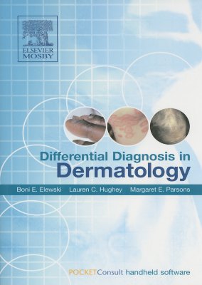 Differential Diagnosis in Dermatology - Elewski, Boni E, and Hughey, Lauren, and Parsons, Margaret E, MD