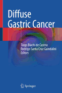 Diffuse Gastric Cancer