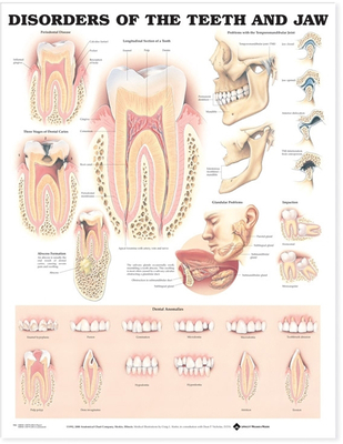 Disorders of the Teeth and Jaw Anatomical Chart - Anatomical Chart Company (Prepared for publication by), and 9866pl1 5