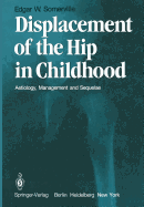 Displacement of the Hip in Childhood: Aetiology, Management and Sequelae