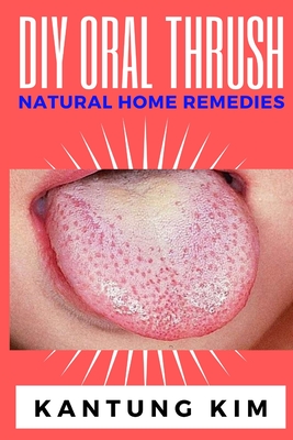 DIY Oral Thrush Natural Home Remedies: The Effective Step By Step Guide To Permanently End Oral Thrush - Kim, Kantung
