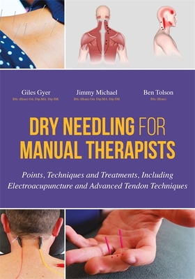 Dry Needling for Manual Therapists: Points, Techniques and Treatments, Including Electroacupuncture and Advanced Tendon Techniques - Gyer, Giles, and Michael, Jimmy, and Tolson, Ben
