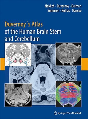 Duvernoy's Atlas of the Human Brain Stem and Cerebellum: High-field MRI, Surface Anatomy, Internal Structure, Vascularization and 3D Sectional Anatomy - Naidich, Thomas P., and Duvernoy, Henri M., and Delman, Bradley N.
