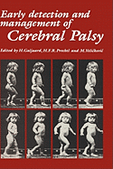 Early Detection and Management of Cerebral Palsy