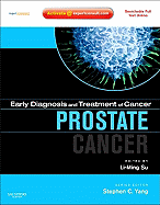 Early Diagnosis and Treatment of Cancer Series: Prostate Cancer: Expert Consult - Online and Print