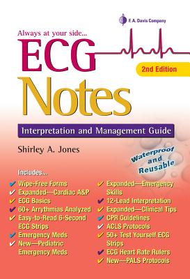 ECG Notes: Interpretation and Management Guide - Jones, Shirley A, Msed, Mha, Msn, RN