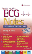 ECG Notes: Interpretation and Management - Jones, Shirley A, MS Ed, Mha, RN