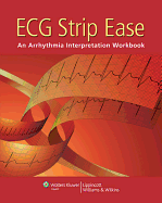 ECG Strip Ease