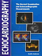 Echocardiography: The Normal Examination of Echocardiographic Measurements