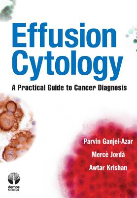 Effusion Cytology: A Practical Guide to Cancer Diagnosis - Ganjei-Azar, Parvin, MD, and Jorda, Merce, PhD, and Krishan, Awtar, PhD