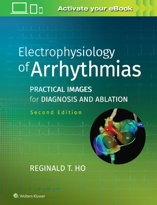 Electrophysiology of Arrhythmias: Practical Images for Diagnosis and Ablation - Ho, Reginald T, MD
