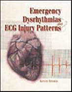 Emergency Dysrhythmias and ECG Injury Patterns - Brown, Kevin R