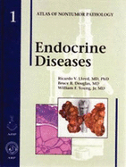 Endocrine Diseases