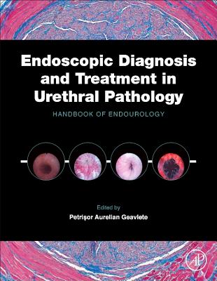 Endoscopic Diagnosis and Treatment in Urethral Pathology: Handbook of Endourology - Geavlete, Petrisor Aurelian (Editor)