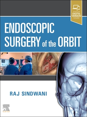 Endoscopic Surgery of the Orbit - Sindwani, Raj