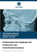 Endoskopische Zug?nge bei Frakturen des Unterkieferkondylus