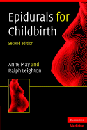Epidurals for Childbirth