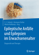 Epileptische Anfalle und Epilepsien im Erwachsenenalter: Diagnostik und Therapie