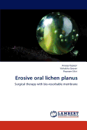 Erosive Oral Lichen Planus