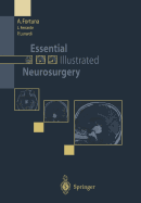Essential Illustrated Neurosurgery - Fortuna, A, and Ferrante, L, and Lunardi, P