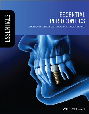 Essential Periodontics - Smith, Steph (Editor), and Almas, Khalid (Editor)