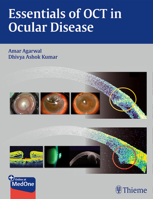 Essentials of OCT in Ocular Disease - Agarwal, Amar (Editor), and Kumar, Dhivya Ashok (Editor)