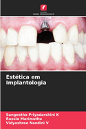 Est?tica em Implantologia