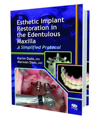 Esthetic Implant Restoration in the Edentulous Maxilla: A Simplified Protocol - Dada, Karim, and Daas, Marwan