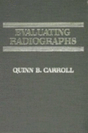 Evaluating Radiographs