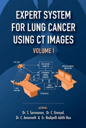 Expert System for Lung Cancer Using CT Images - Volume 1: Application of Medical Image processing for Expert Systems