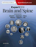 Expertddx: Brain and Spine